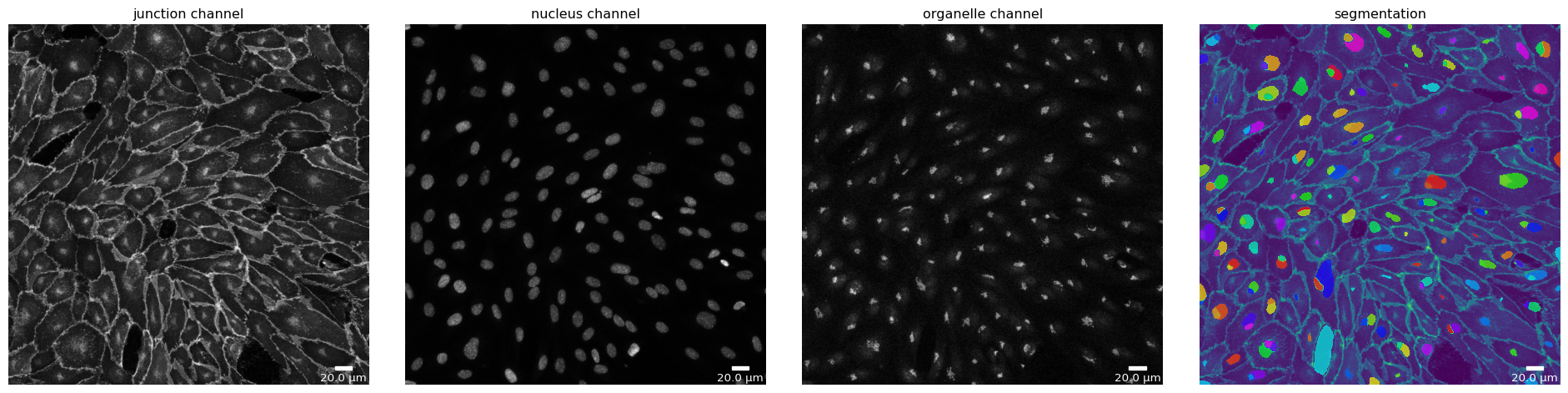 ../_images/notebooks_polarityjam-notebook_seg_20_1.png