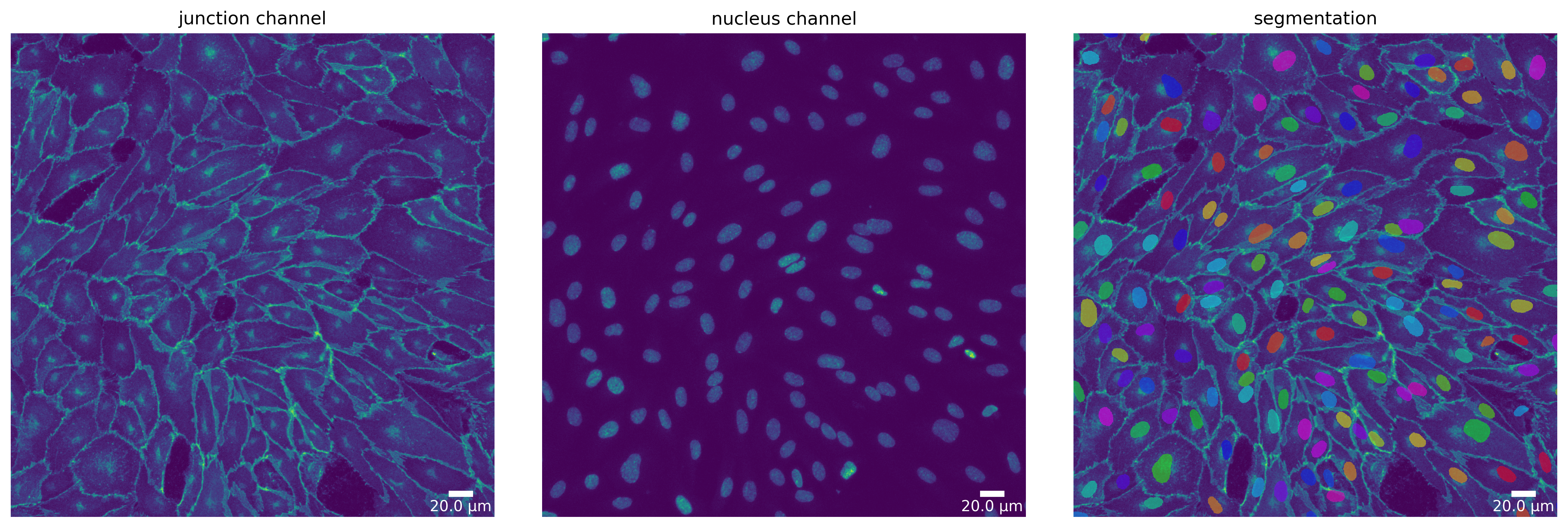 ../_images/notebooks_polarityjam-notebook_seg_15_1.png
